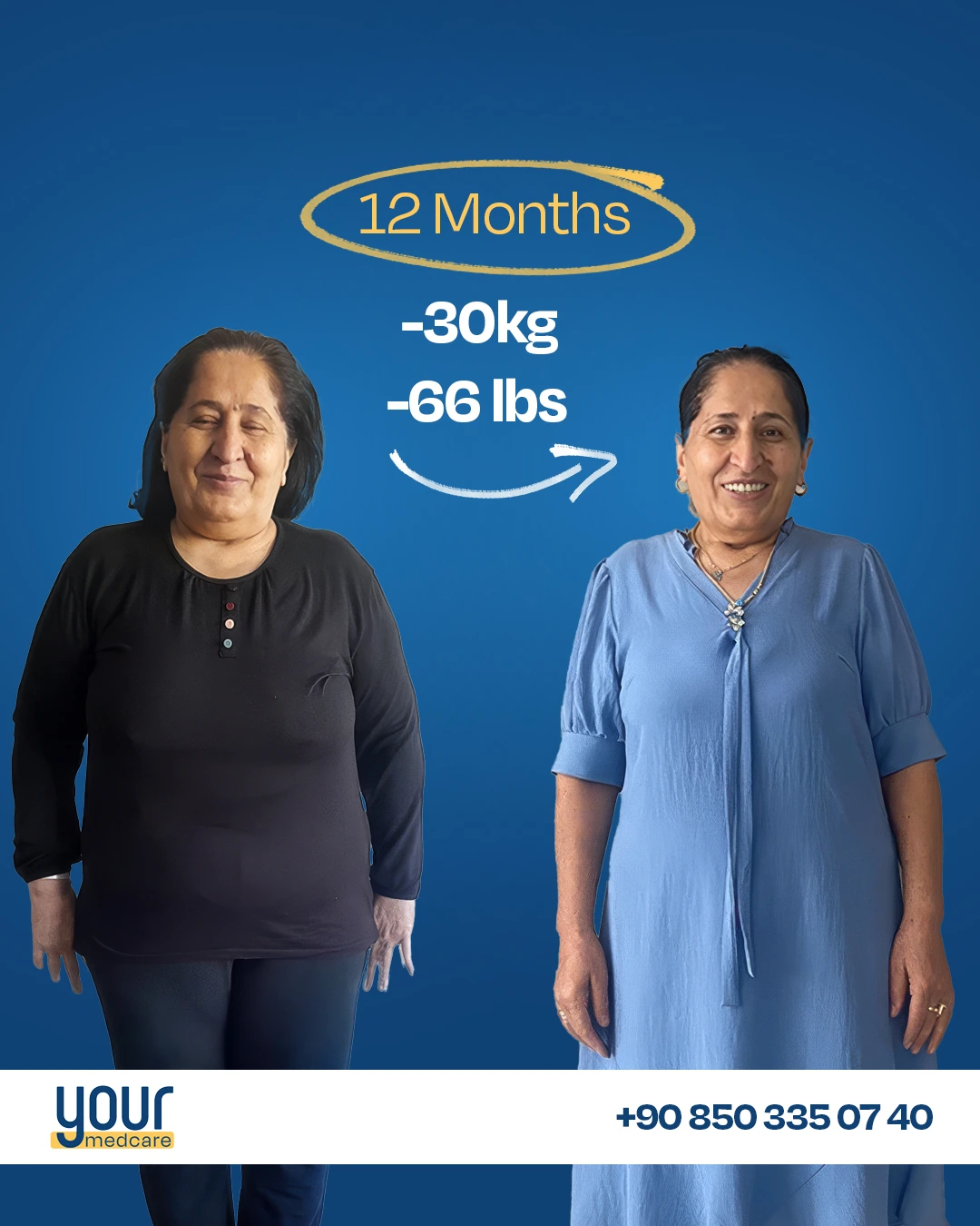 Patient result -30kg in 12 months