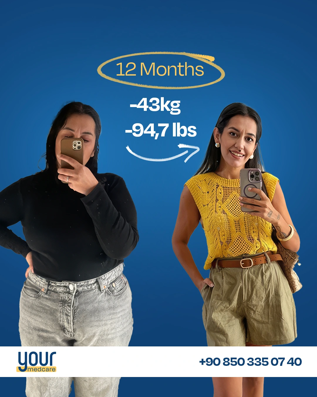 Patient result -43kg in 12 months