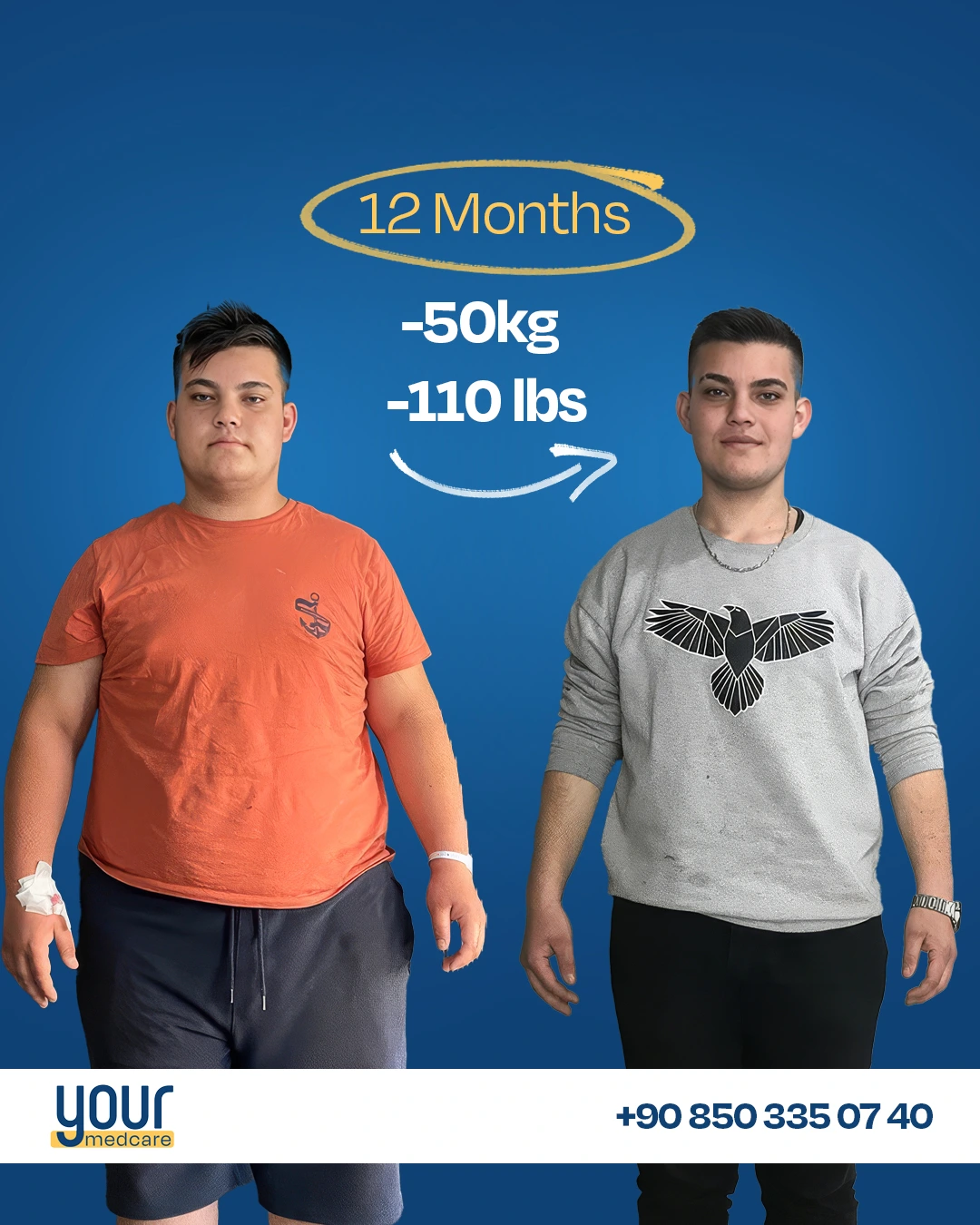 Patient result -50kg in 12 months