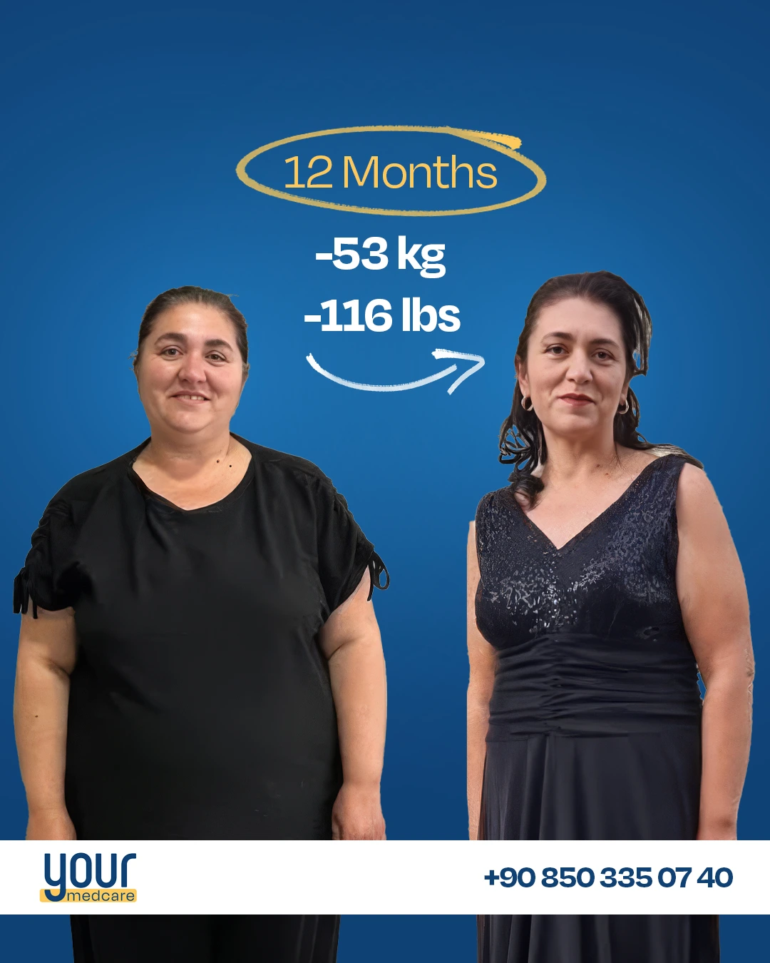 Patient result -53kg in 12 months