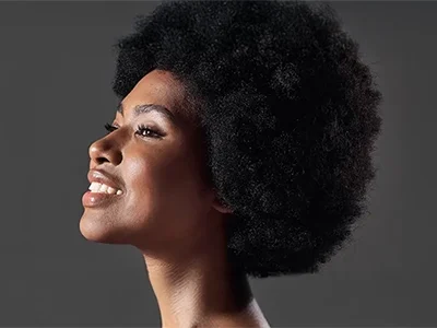 siyahi burun-500*300-2