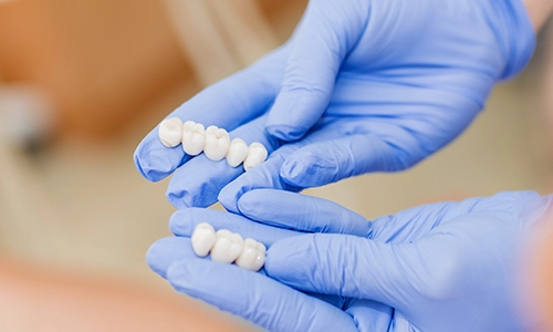Zirconia Crowns -500x300