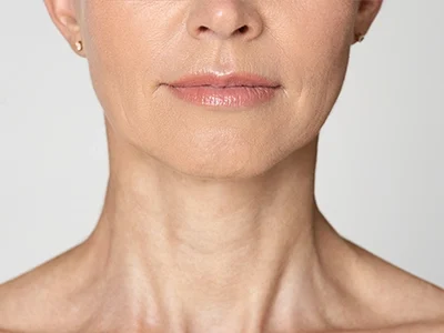 minifacelift-500*300webp