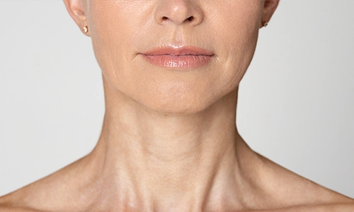 minifacelift-500*300webp