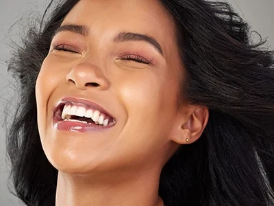 prepless veneers-500300 copy