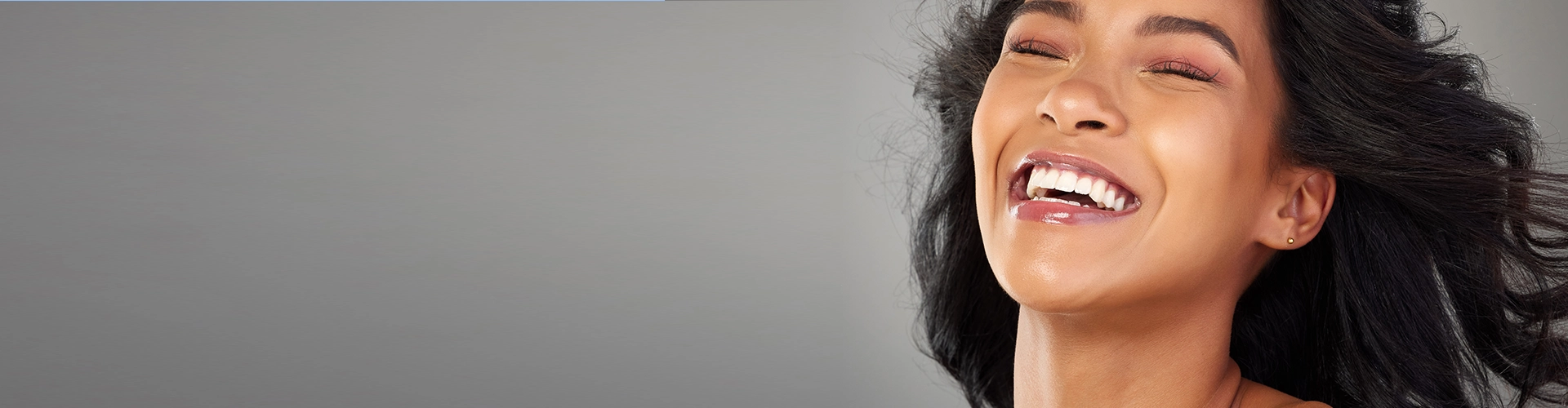 Zahnveneers