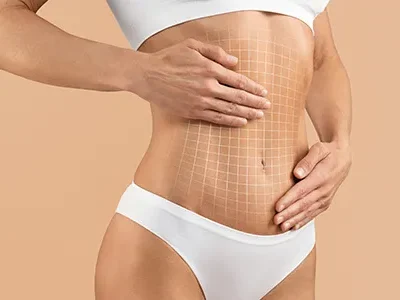 tummy tuck-500*300