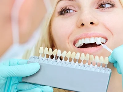 Ceramic Veneers-500x300