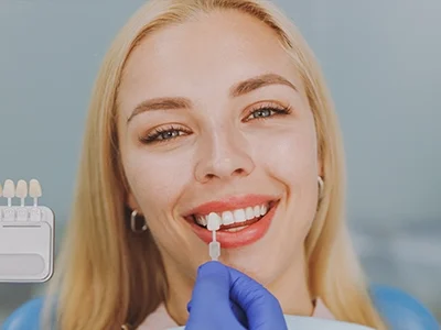 Emax Veneers-500x300