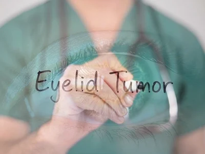 Eyelid Tumor-2
