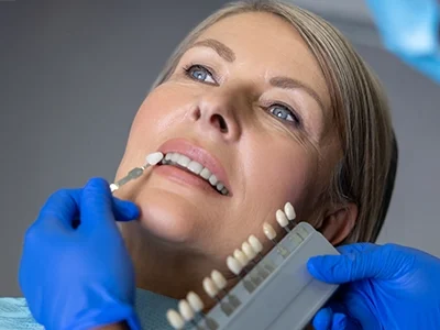 Porcelain Veneers-500300