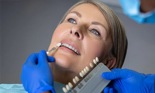 Porcelain Veneers-500300