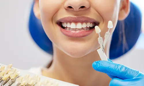 Ceramic vs Composite Veneers: Direct or Indirect – 7 Key Differences to Choose the Right Smile