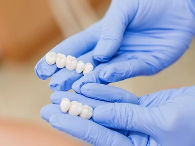 Zirconia Crowns -500x300