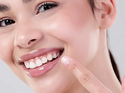 gingivectomy-500300 copy