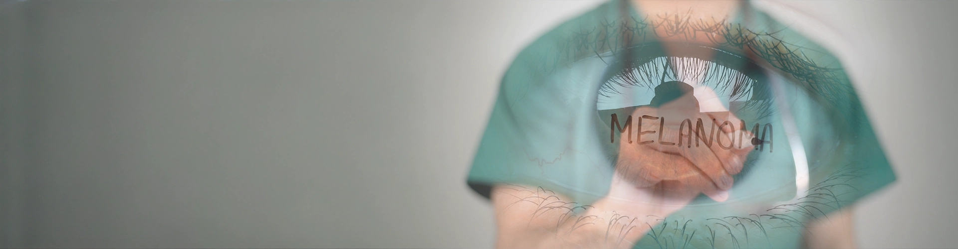 Uveal Melanoma